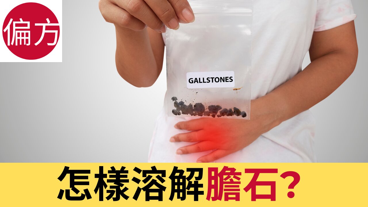 怎樣溶解膽石?