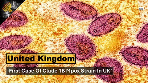 'First Case Of Mpox Clade 1b Strain In UK' (subtitles)