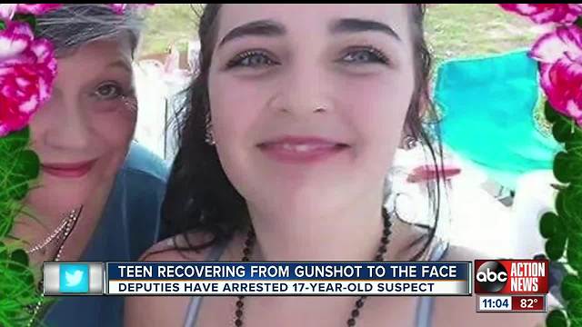 Deputies arrest 17YO gunman who reportedly shot girl in face at Spring Hill apartment complex