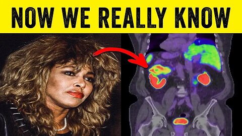 🔴 JUST BEFORE SHE DIED! TINA TURNER WAS IN...