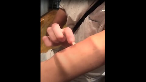 Arms Shouldn't Look Like This