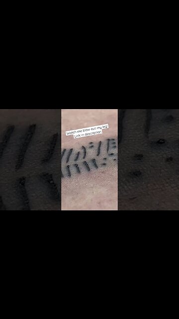 Watch Me Blow Out My Leg 👀🩸