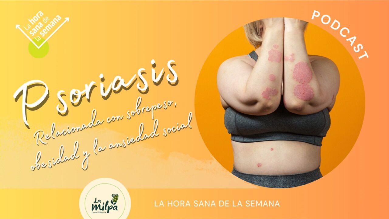 Psoriasis - Relacionada con Sobrepeso, Obesidad y Ansiedad Social