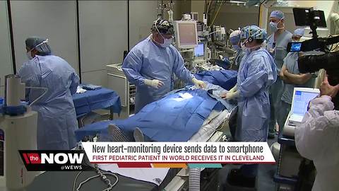 Northeast Ohio teen is first in country to have new smartphone-compatible cardiac monitor implanted