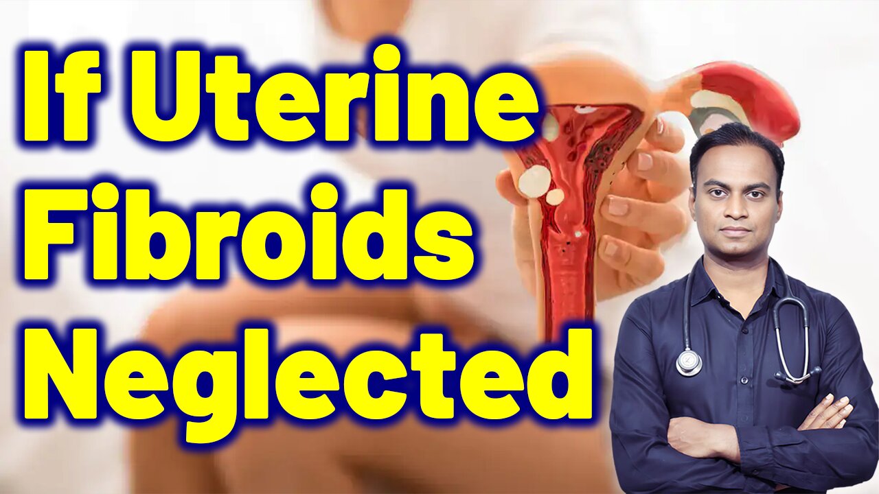 What Happens If You Neglect uterine Fibroids? | Treatment Cure Medicine | Gynaecology Women Female