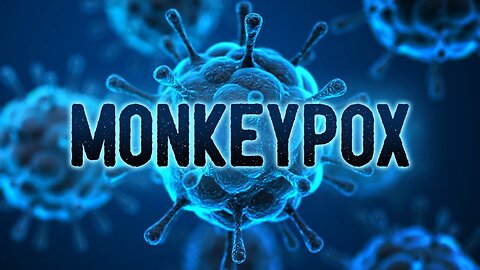 VladTalks | Monkeypox | Daily