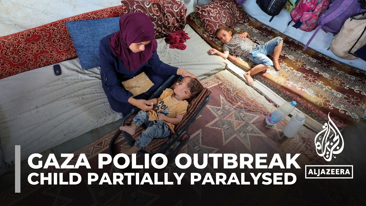 Polio in tent camp for the displaced: Child infected with polio cannot walk nor crawl