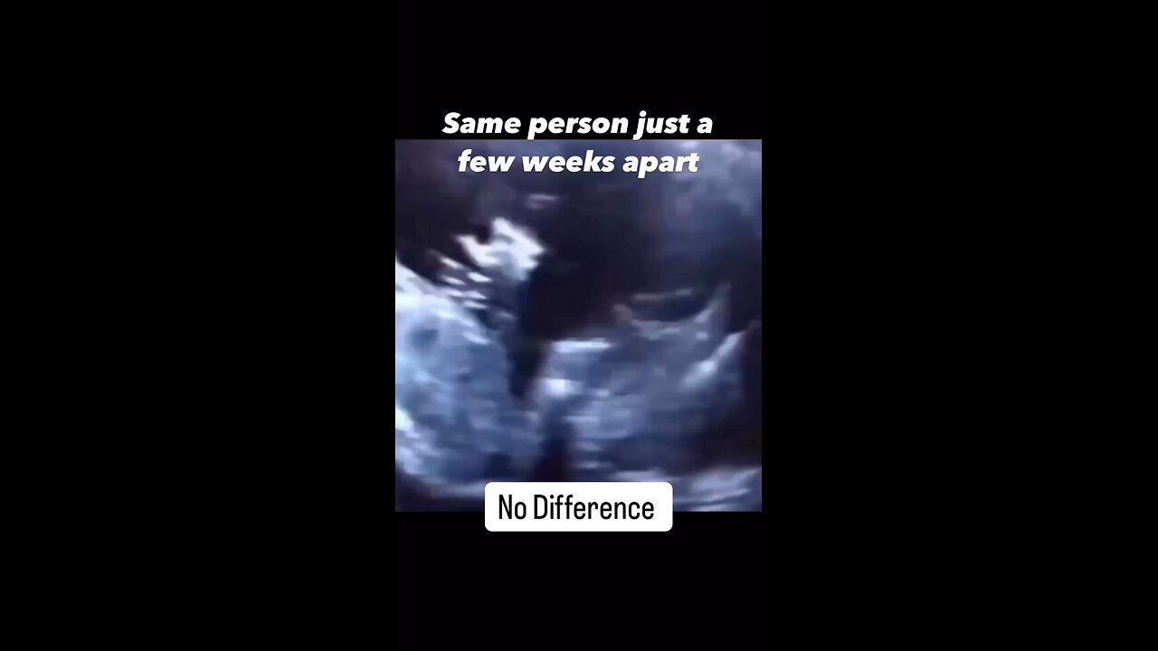 Life begins at conception