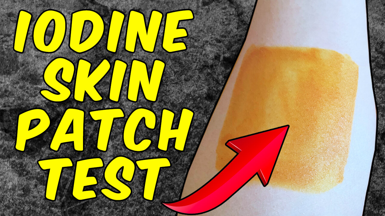 How to Perform the Iodine Patch Test