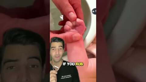 Baby Reflexes