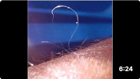Morgellons fibers in CV 19 tests - FULL VIDEO OF MOVING FIBERS