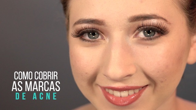 Como cobrir as marcas de acne.