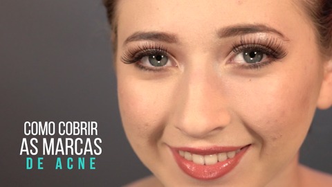 Como cobrir as marcas de acne.
