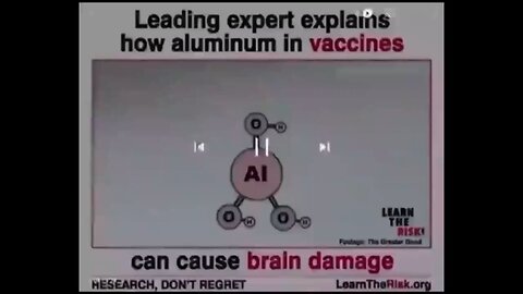 Al. VX Brain Damage