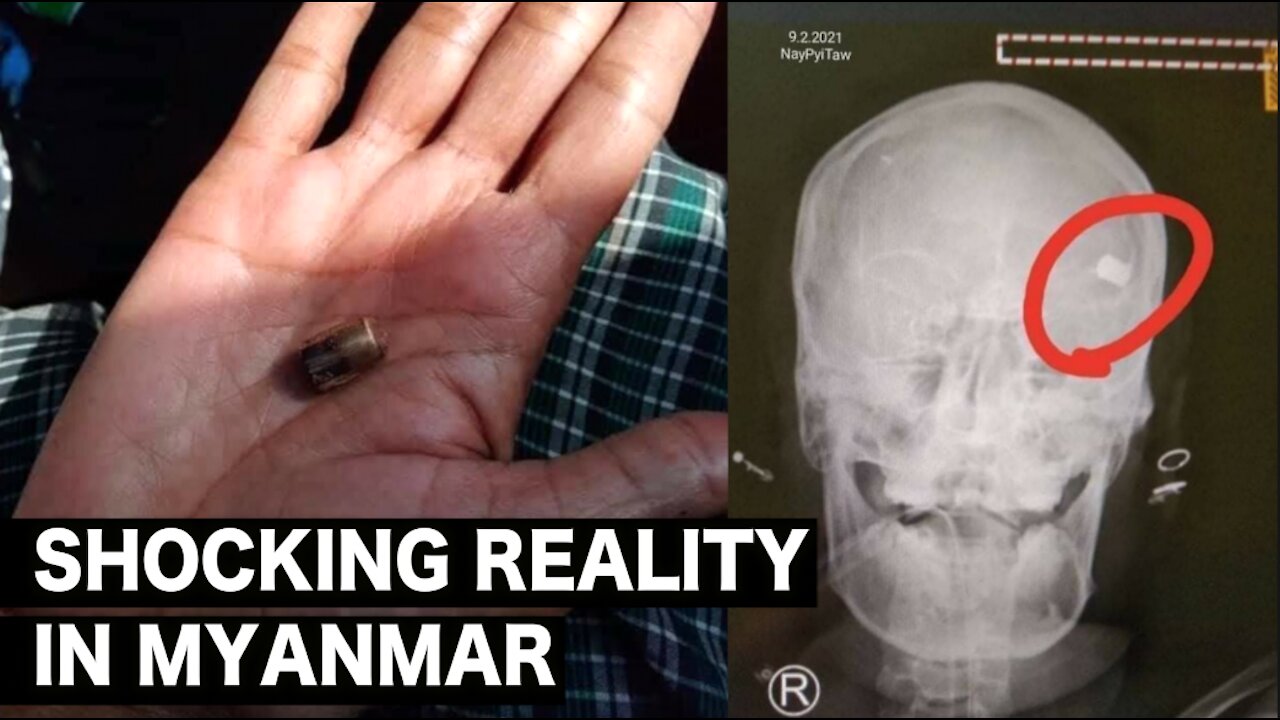 Shocking reality in Myanmar