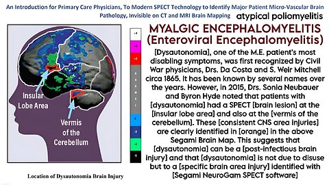 Testing for Myalgic Encephalomyelitis (M.E.) (Cleanvoice Enhanced A.I. Sound Remaster) - Jodi Bassett