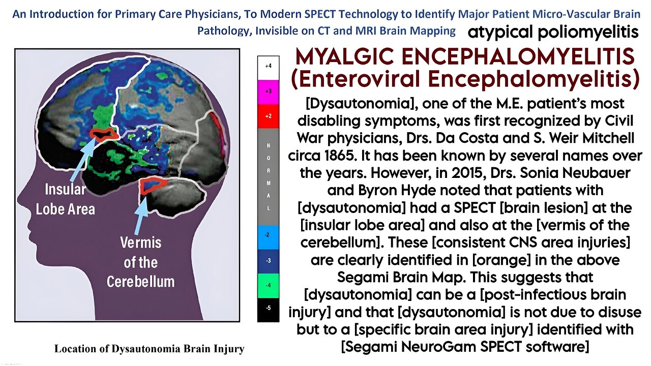 Testing for Myalgic Encephalomyelitis (M.E.) (Cleanvoice Enhanced A.I. Sound Remaster) - Jodi Bassett