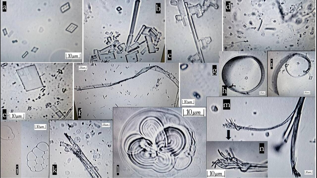 ⚠️ Recent Study Shows Self-Assembly Nanobots in the COVID-19 Injectables....