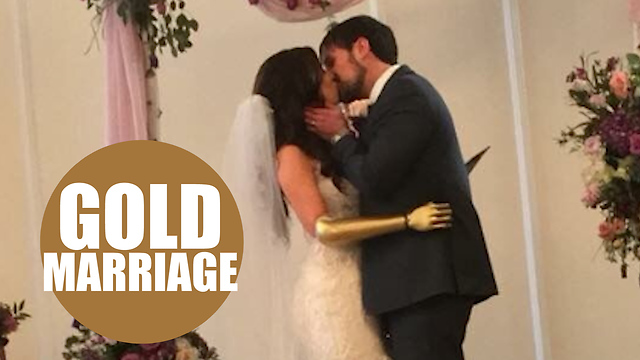 Bionic model ditches her black prosthetic for a sparkly gold limb for her wedding day