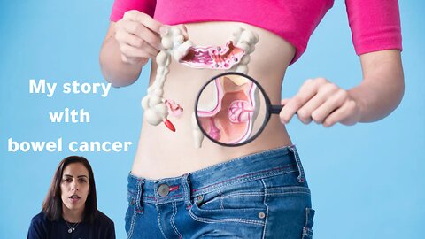 My story with bowel cancer