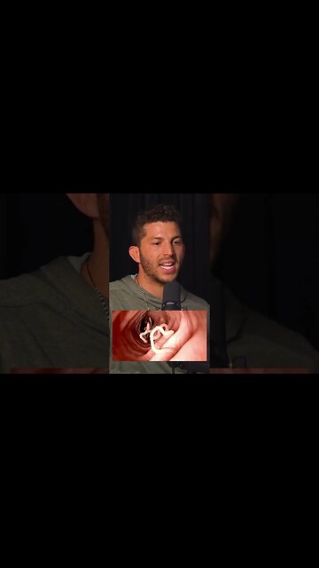 Parasite cleanse? DO THIS!! #detox #parasitecleanse #detoxification #cleanse #guthealth