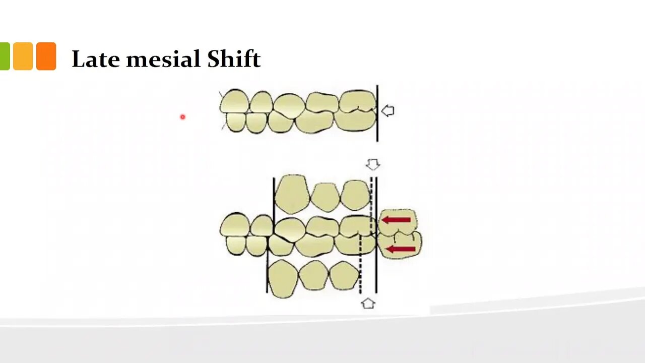 orthodontics L8 (deciduous and permanent dentition 2)