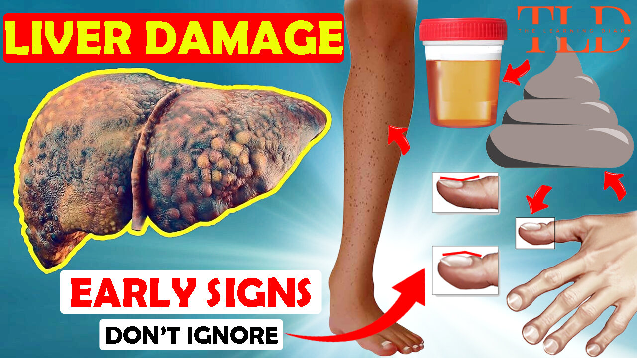 🚨 Warning: 10 Warning Signs of Liver Damage You Can't Ignore! 🚨