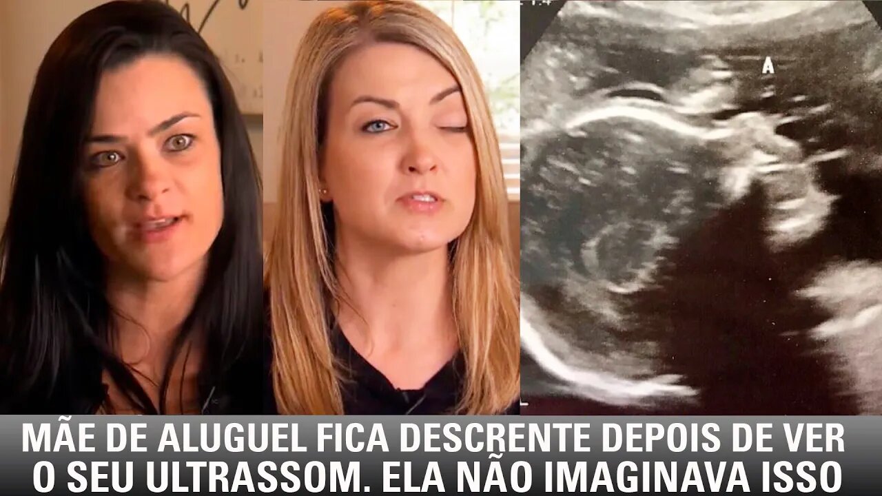 Mãe de aluguel fica descrente depois de ver o seu ultrassom. Ela não imaginava isso.