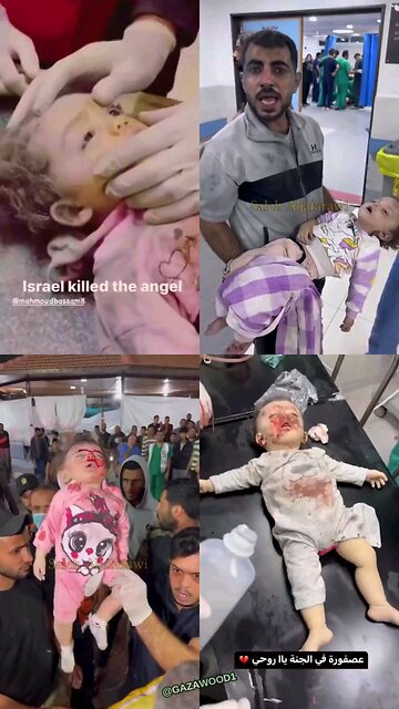 Pallywood - How many times can the same baby get wounded or die? Hmmm...