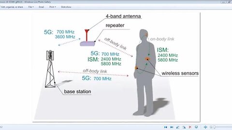 5G WEAPON NEURO WBAN ATTACKING FREEDOM MOVEMENT THEY ARE COMING TO ATTACK YOU