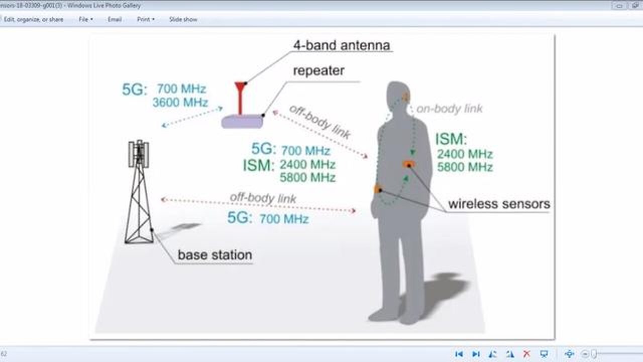 5G WEAPON NEURO WBAN ATTACKING FREEDOM MOVEMENT THEY ARE COMING TO ATTACK YOU
