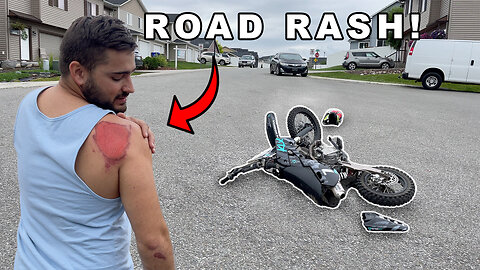 I Crashed My Pit Bike! | Shifter Kart Race