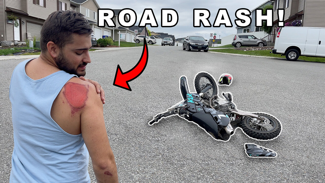 I Crashed My Pit Bike! | Shifter Kart Race