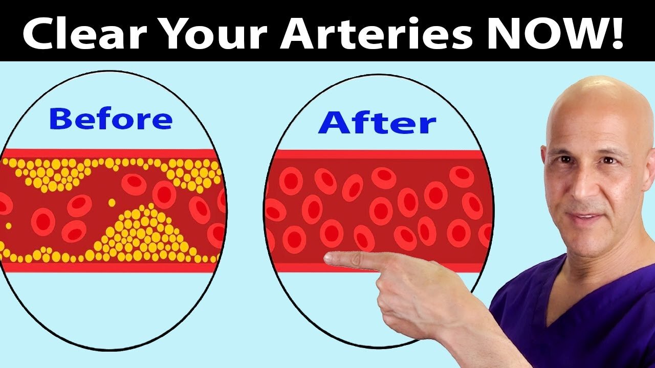 Eat These Foods to Clear Arteries FAST (Stop Heart Attacks & Strokes)