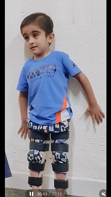 Cerebral palsy home management exercises