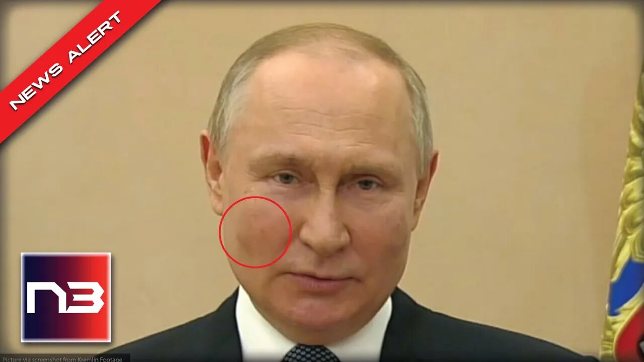 People Noticed That Putin Had Dark Splotches On His Cheeks, Here’s What It Could Be