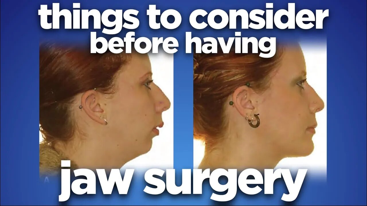 Things to consider before having jaw surgery by dr Mike Mew
