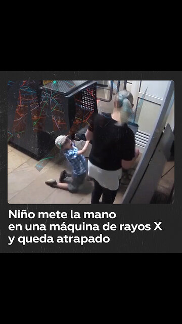 Niño sufre un accidente al poner su mano en una máquina de rayos X en el metro de Moscú