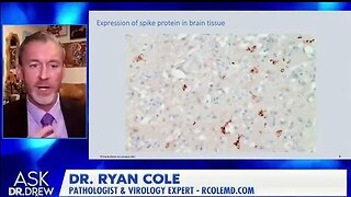 Dr. Ryan Cole - spike protein, literally causing the lymphocytes to chew a hole in the aorta