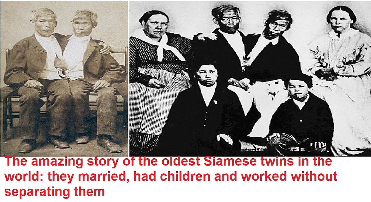 The amazing story of the oldest Siamese twins in the world: married,had children without separating