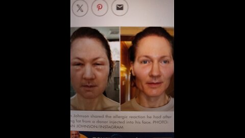 Project baby face failure