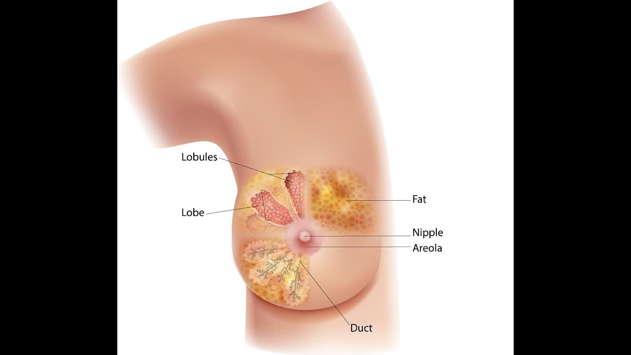 Theratechnologies - Triple Negative Breast Cancer technology