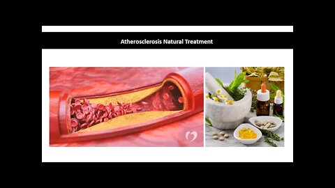 Atherosclerosis Natural Treatment