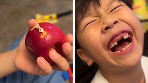 Boy's Funny Reaction After Breaking His Teeth And Getting Stuck In An Apple