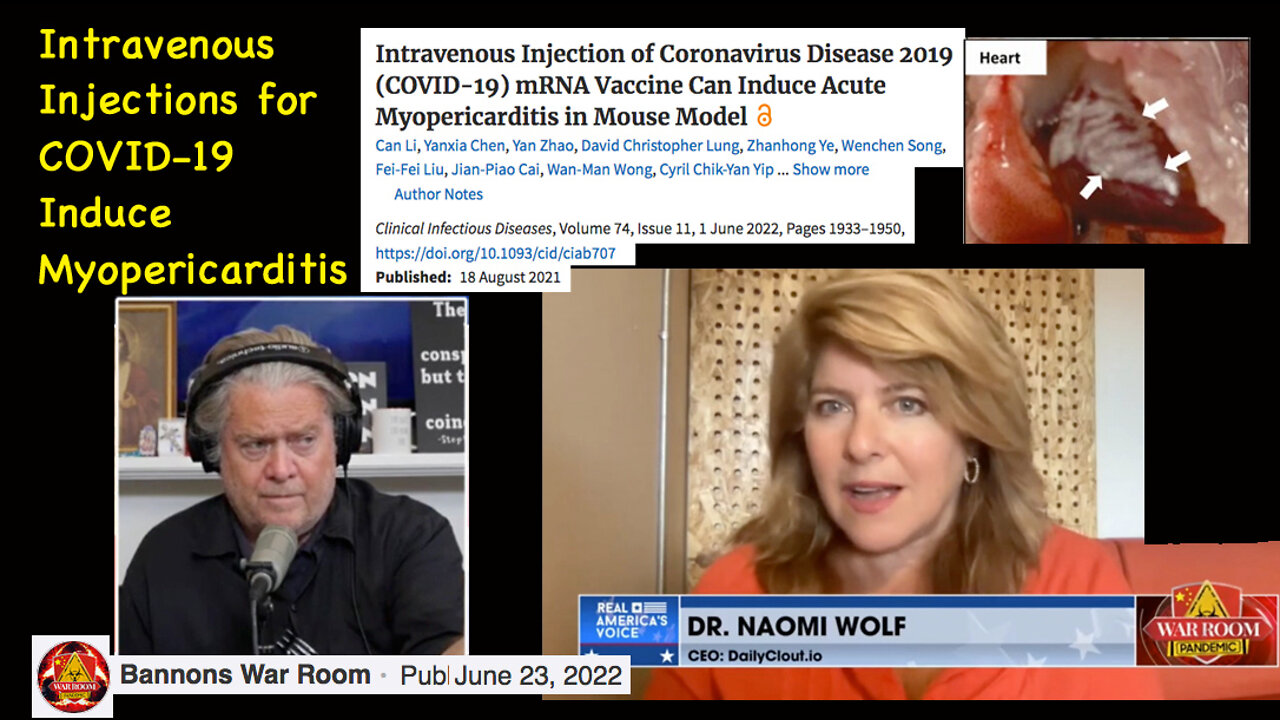 Intravenous Injection for COVID-19 Induce Myopericarditis