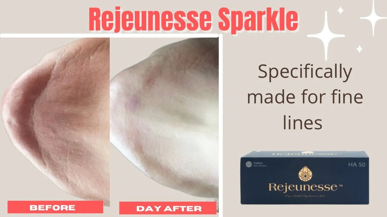 Correct Fine Lines Rejeunesse Sparkle - Estaderma SASSY15 saves 15%