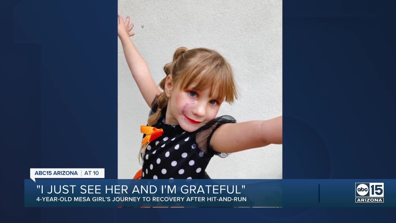 Mesa 4-year-old girl's journey to recovery after being hit by a car last year