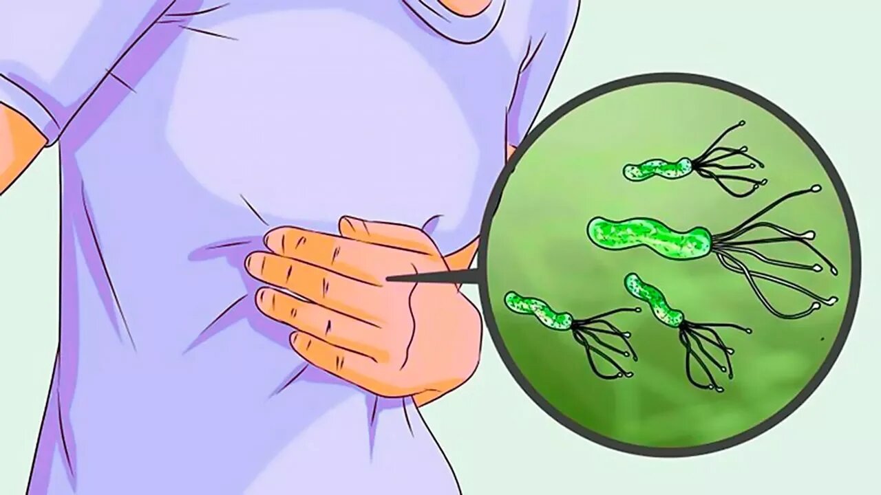 6 Proven Natural Remedies for H. Pylori