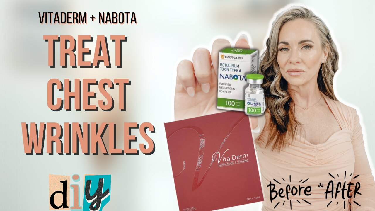 CHEST WRINKLES TREATMENT! 2 Tricks The Competition Knows, But You Don't