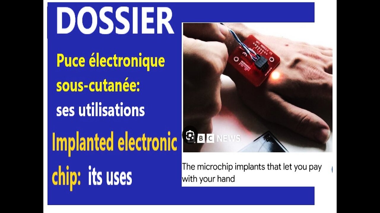 (Fra_EN) Microchip: facts, people use it _ PUCE SOUS-CUTANÉE: c'est réel, maintenant